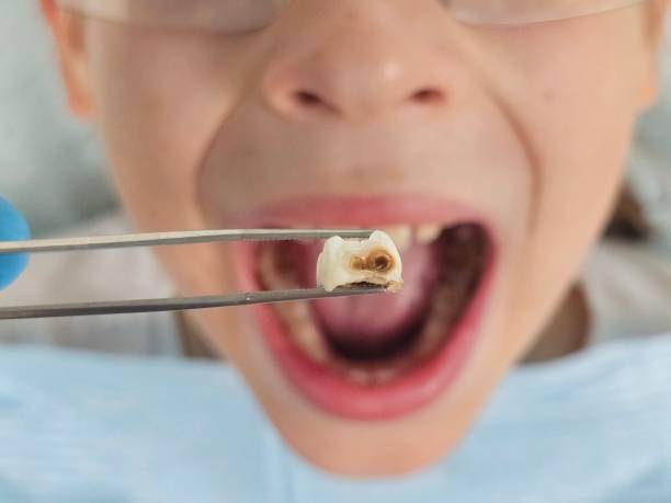 Best Knocked-Out Tooth Emergency  in Hawthorne, FL